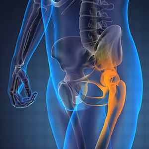 Hip & Leg Injury Rehab | THERAMEDIC REHAB